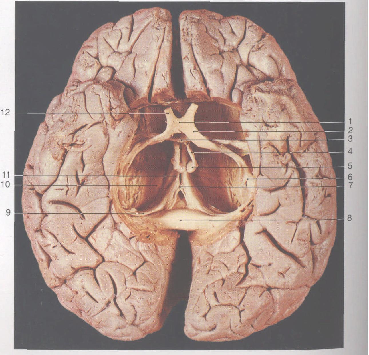 96. 穹窿和海马-颅脑颈部应用解剖-医学